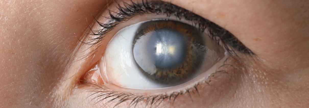 eye care