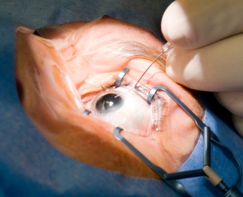 eye care