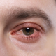eye care