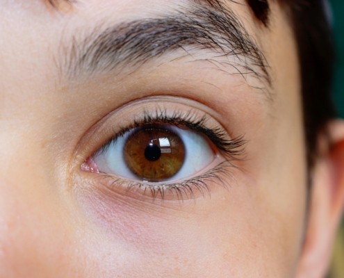 Is Cataract Surgery Painful