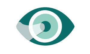 Pterygiums eye care faqs