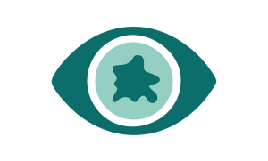 Uveitis eye care faqs