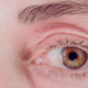 Eye Specialist in Mbombela