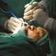 Retinal detachment